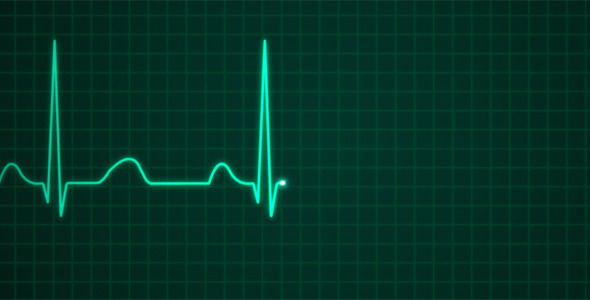 VideoHive EKG Electrocardiography 2317767 VideoHive EKG Electrocardiography 2317767
