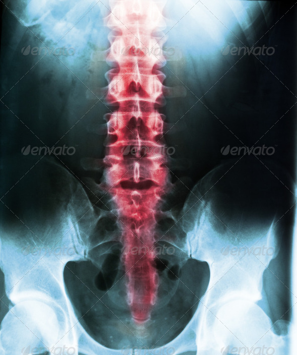XRay human body - Stock Photo - Images