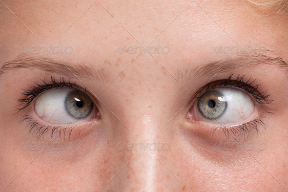 closeup of cross-eyed of a beautiful woman