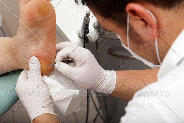 Chiropodists working with a scalpel