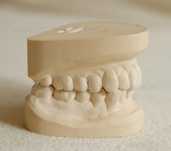 Dental gypsum model mould of teeth (Misc) Photo Download