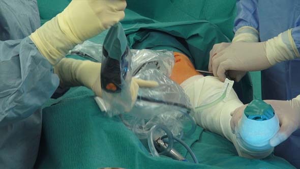 Knee Surgery Sports Traumatology Arthroscopy 3 Knee Surgery Sports Traumatology Arthroscopy 3