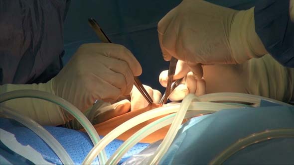 Gynaecology And Laparoscopy Gynaecology And Laparoscopy