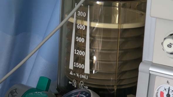Medical Ventilators Or Respirators Medical Ventilators Or Respirators