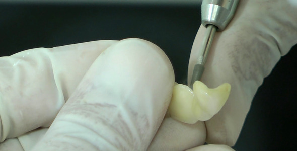 Dental Laboratory Tooth Work Dental Laboratory Tooth Work