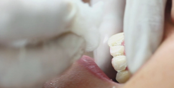 Young Girl in Dentist 5 Young Girl in Dentist 5