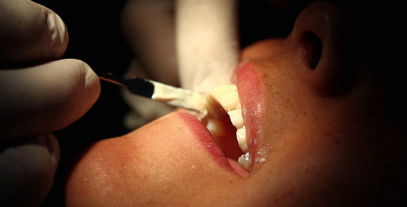 Young Girl in Dentist 8 Young Girl in Dentist 8