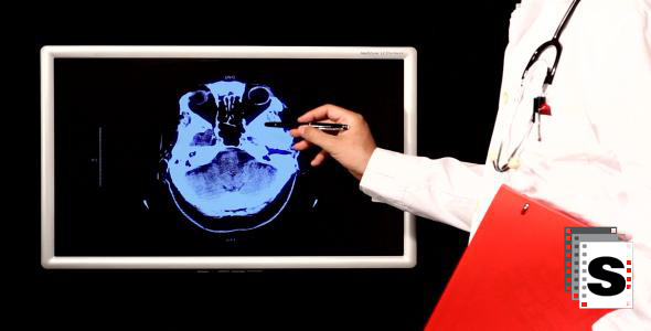 Doctor Analysing X-rays and CT Scan Doctor Analysing X-rays and CT Scan