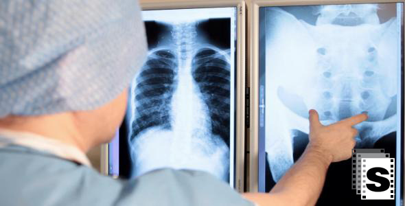 Surgeon Examine X-ray Surgeon Examine X-ray