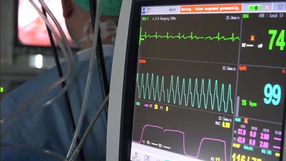 VideoHive Multi Parameter Patient Monitor 4 9714413 VideoHive Multi Parameter Patient Monitor 4 9714413