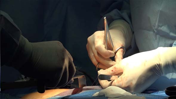 VideoHive Surgeon s Hands and Medical Gloves 9715112 VideoHive Surgeon s Hands and Medical Gloves 9715112