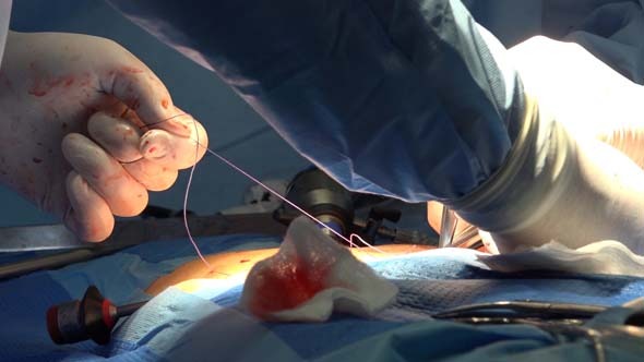 VideoHive Surgical Suture Or Stitches 3 9715574 VideoHive Surgical Suture Or Stitches 3 9715574