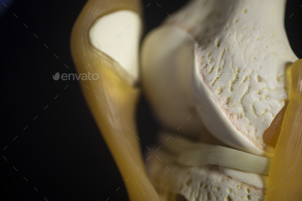 Medical knee joint meniscus plastic demonstration teaching model (Misc) Photo Download