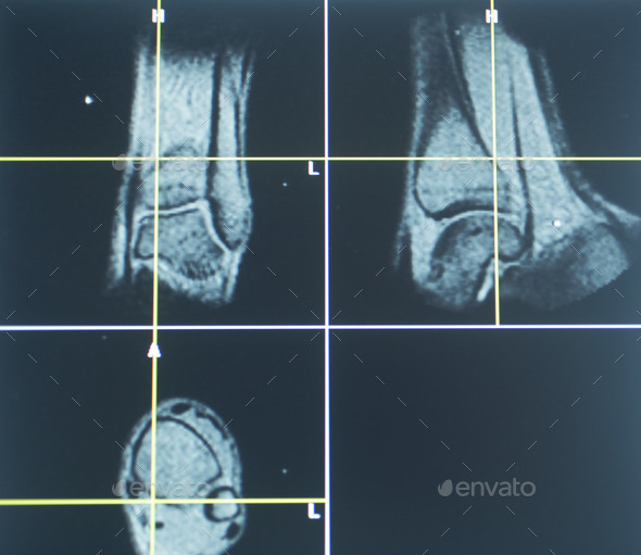 Human knee open MRI CT scan (Misc) Photo Download