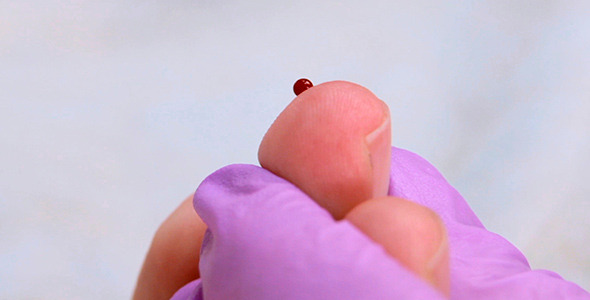 A Blood Test 1 A Blood Test 1