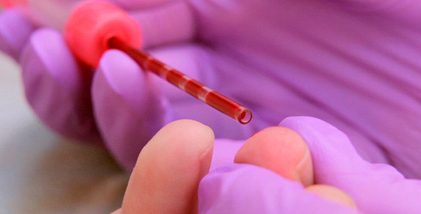 A Blood Test 2 A Blood Test 2