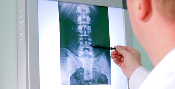 The Doctor Examines An X-Ray Picture 1 The Doctor Examines An X-Ray Picture 1