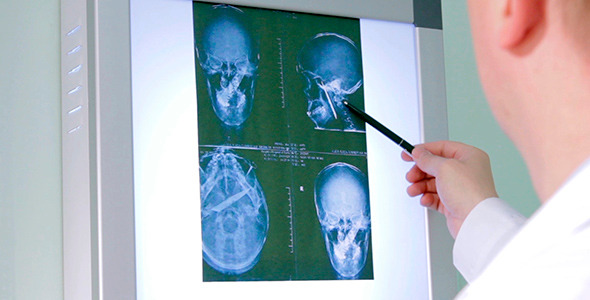 The Doctor Examines An X-Ray Picture 2 The Doctor Examines An X-Ray Picture 2