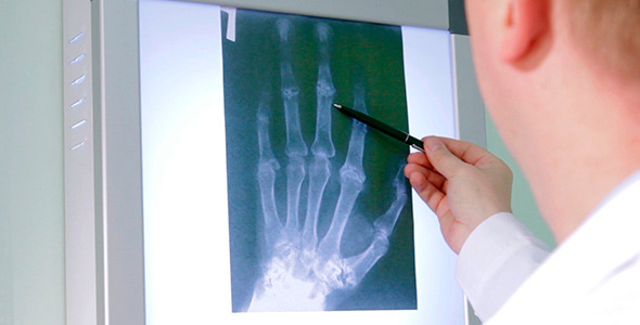 The Doctor Examines An X-Ray Picture 3 The Doctor Examines An X-Ray Picture 3
