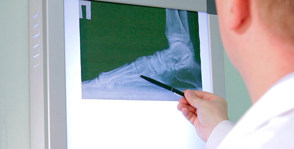 The Doctor Examines An X-Ray Picture 4 The Doctor Examines An X-Ray Picture 4
