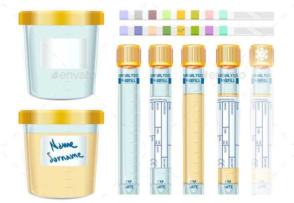 Urinalysis Yellow Cap Tubes Set (Objects)