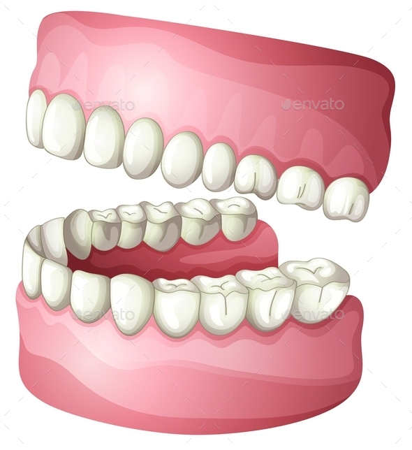 GraphicRiver Denture 10390776 GraphicRiver Denture 10390776