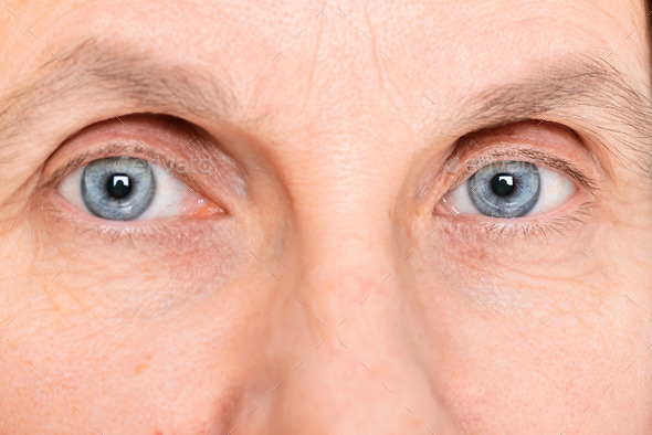 Eyes with Contact Lenses (Misc) Photo Download