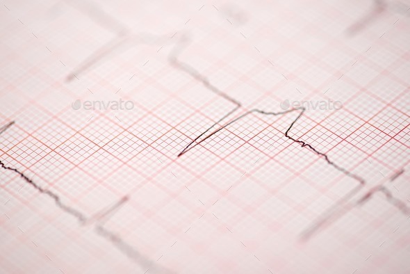 Electrocardiogram (Misc) Photo Download