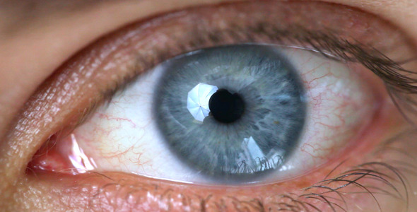 Eye Eye