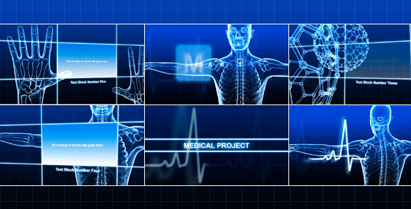 Medical Project Medical Project