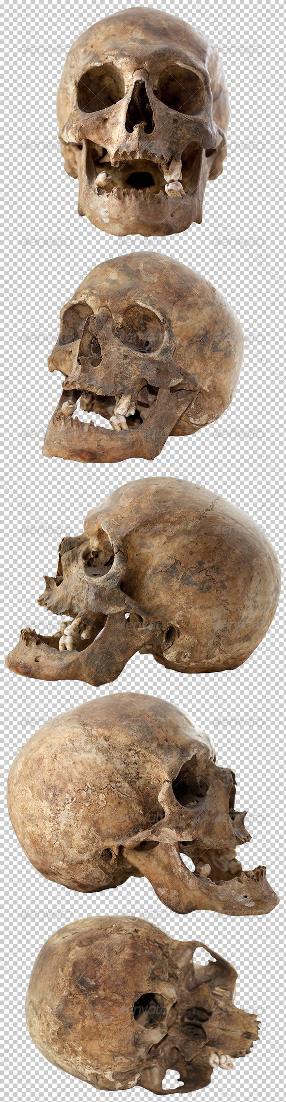 Five Human Skulls Set Five Human Skulls Set