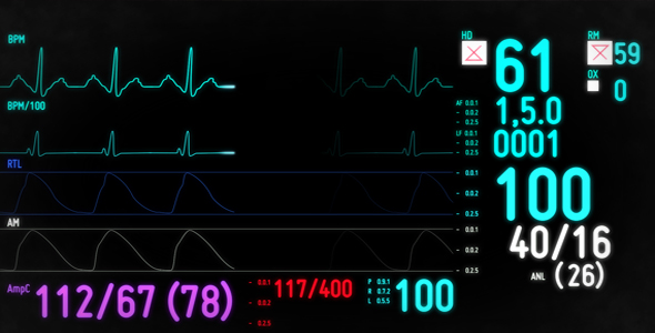 Electrocardiogram Monitor Electrocardiogram Monitor