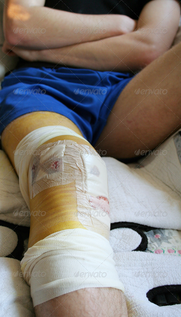 injury knee bandages
