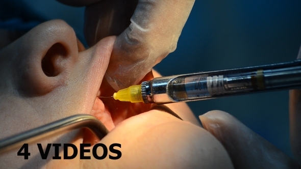 Dental Surgery 01 4 Videos Dental Surgery 01 4 Videos