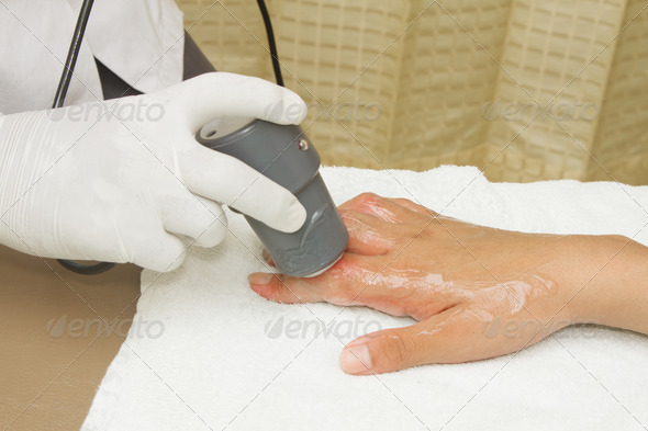 Physiotherapist is applying ultrasound therapy on the hand