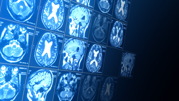 Magnetic Resonance Imaging Magnetic Resonance Imaging