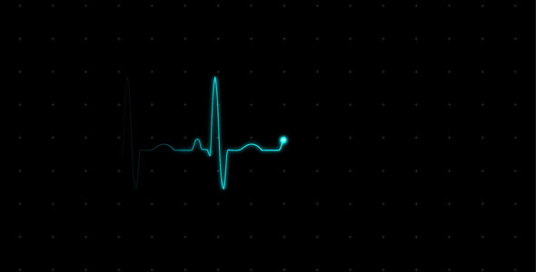EKG Heartbeat Monitor Electrocardiogram EKG Heartbeat Monitor Electrocardiogram
