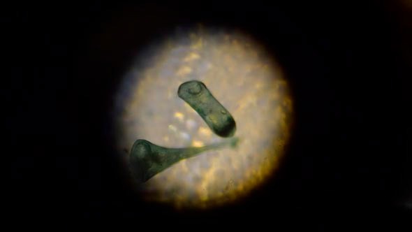 Stentor Polymorphus 3 Stentor Polymorphus 3