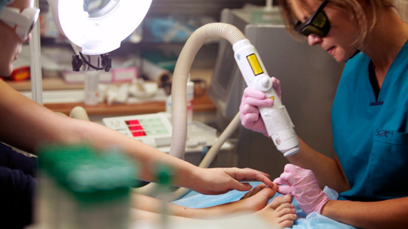 Podiatrist Treating onychomycosis With A Laser Podiatrist Treating onychomycosis With A Laser