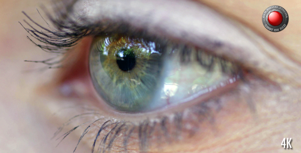 Eye 2 Eye 2