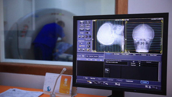 Magnetic Resonance Imaging Human Brain Magnetic Resonance Imaging Human Brain