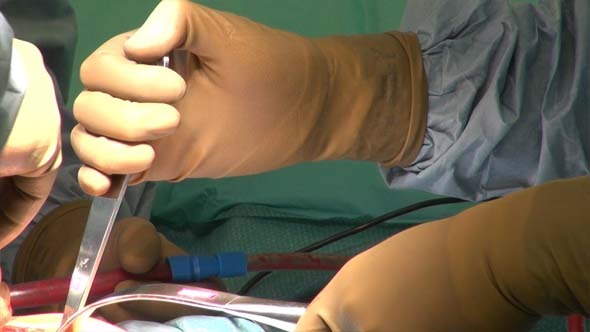 Hip Replacement and Doctor s Hands 2 Hip Replacement and Doctor s Hands 2