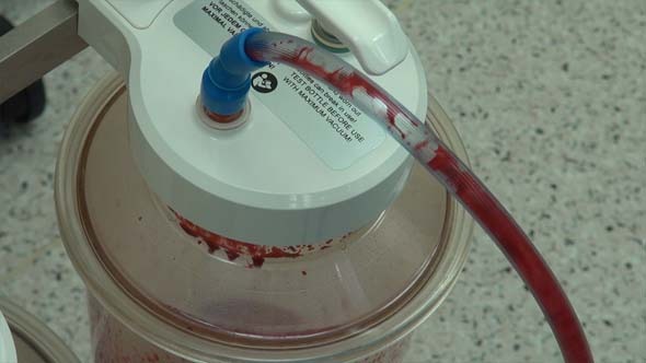 Electric Surgical Suction Pump Electric Surgical Suction Pump